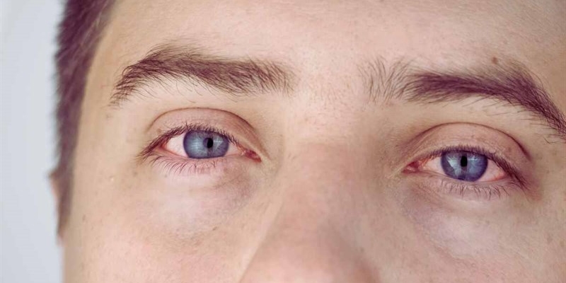 Occhi arrossati, le cause - okmugello.it