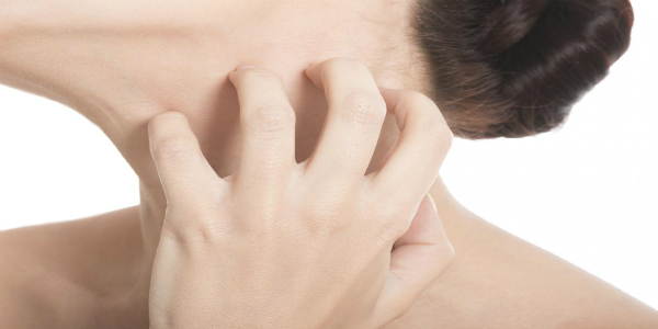 Scabbia, tutto quello che c'è da sapere. Info utili per combattere la malattia