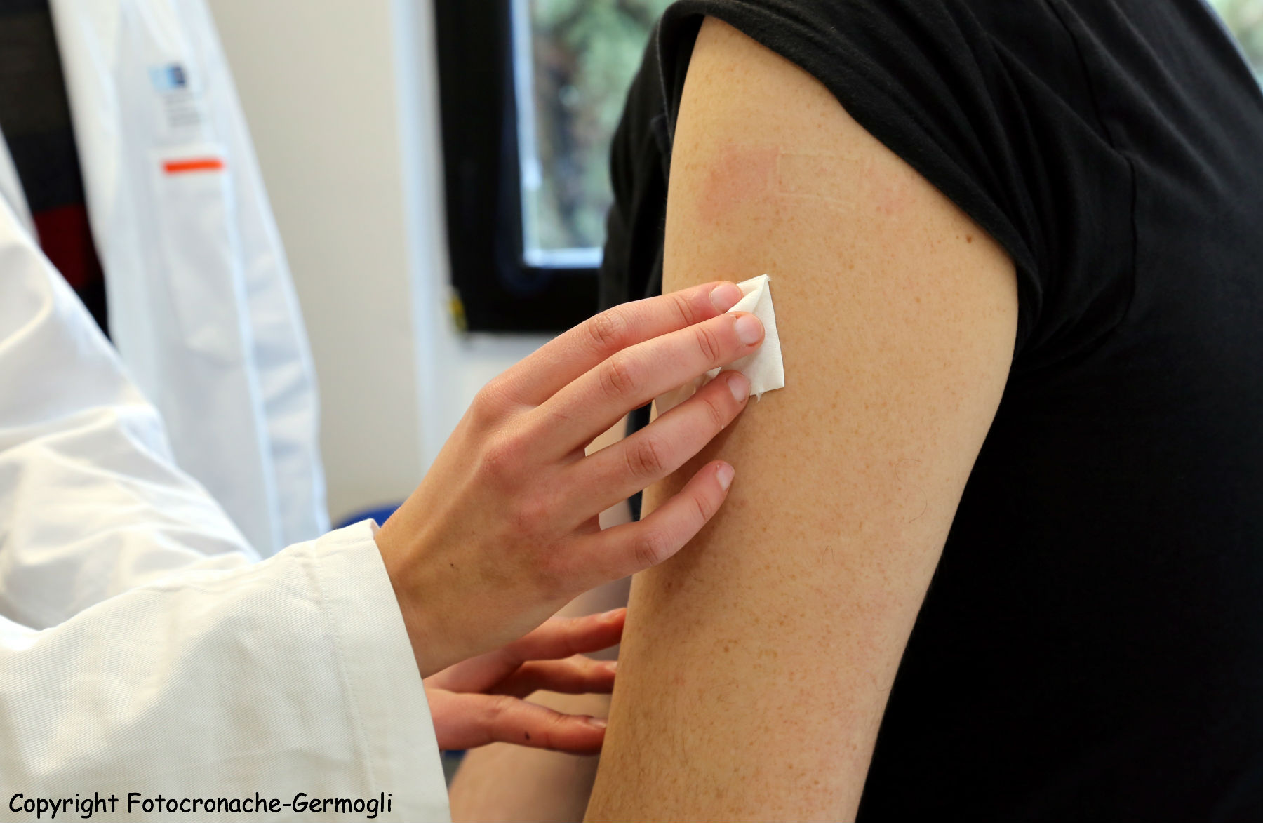 Meningite. Le precauzioni dopo il caso di Prato