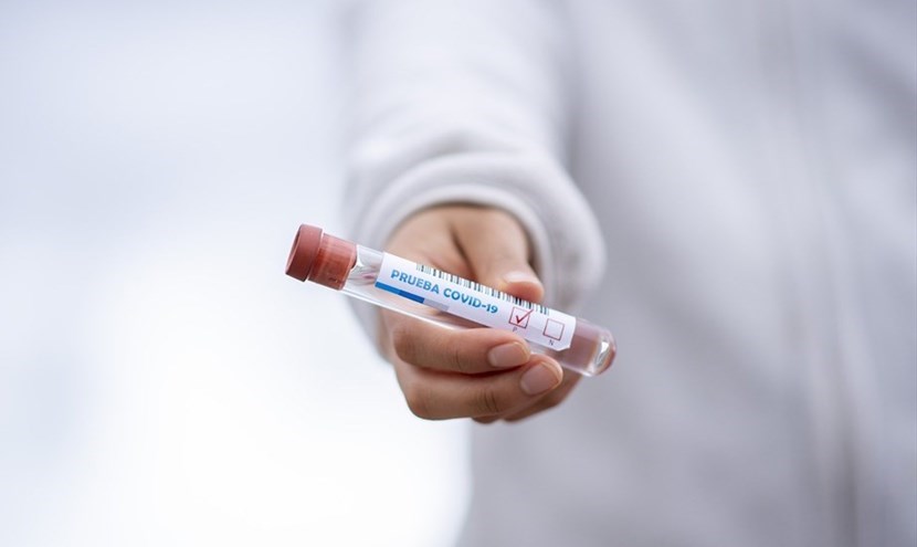 Tampone Coronavirus